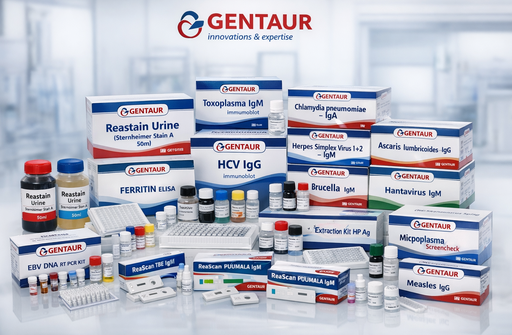 [sk55603] NovaLisa ZIKA virus - IgG Capture